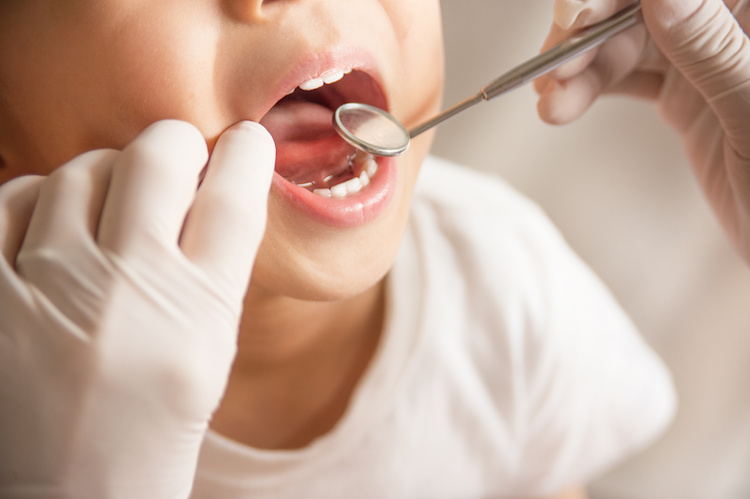 お子様の歯科治療と小児矯正治療